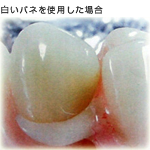 olgpꍇ